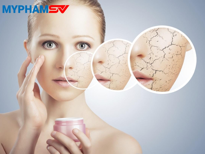 Cách xử lý khi bị dị ứng mỹ phẩm nhanh chóng và an toàn