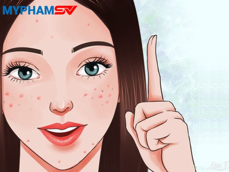 Cách chọn kem chống nắng cho da mụn