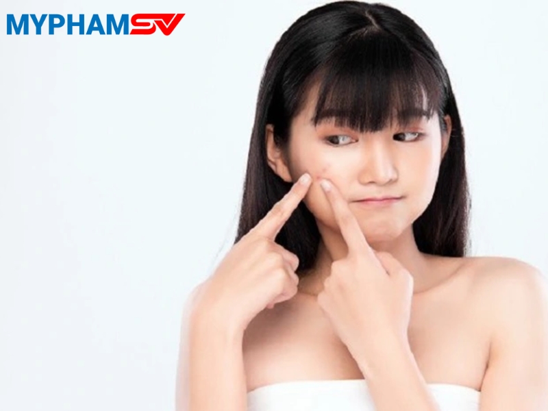 Tuổi teen nên chọn gì? Mỹ phẩm nào phù hợp da tuổi dậy thì?