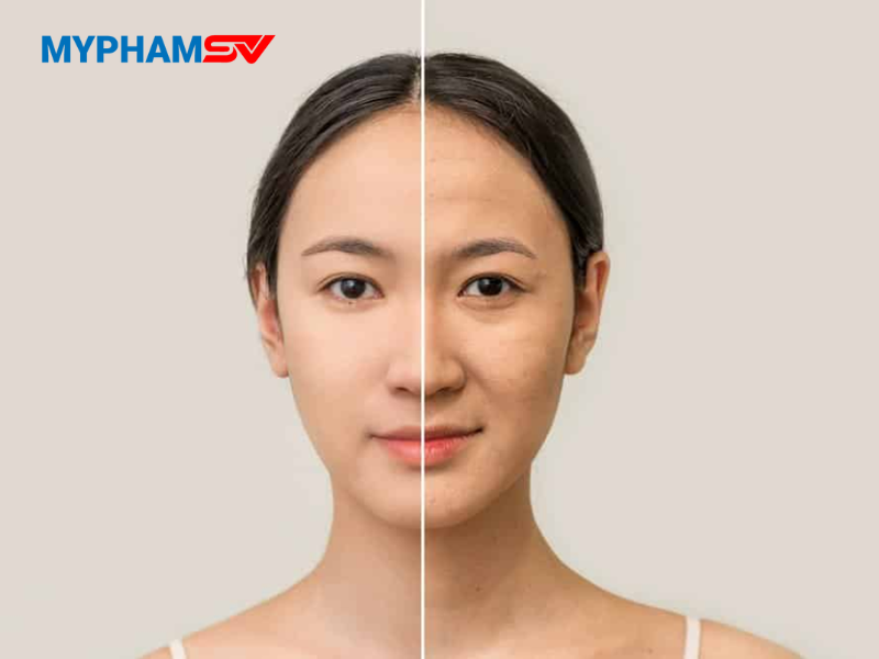 Cách nhận biết serum bị oxy hóa 
