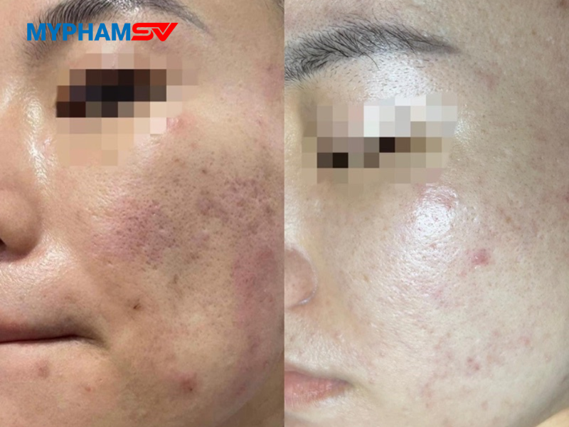Cách nhận biết serum bị oxy hóa 