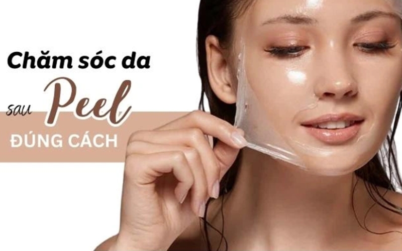 Kem dưỡng phục hồi sau peel da
